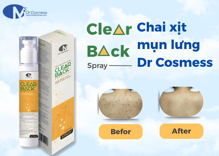 Chai xịt mụn lưng Dr Cosmess Clearback Spray