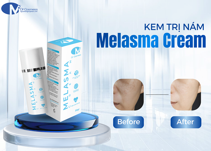 Kem trị nám Melasma Cream