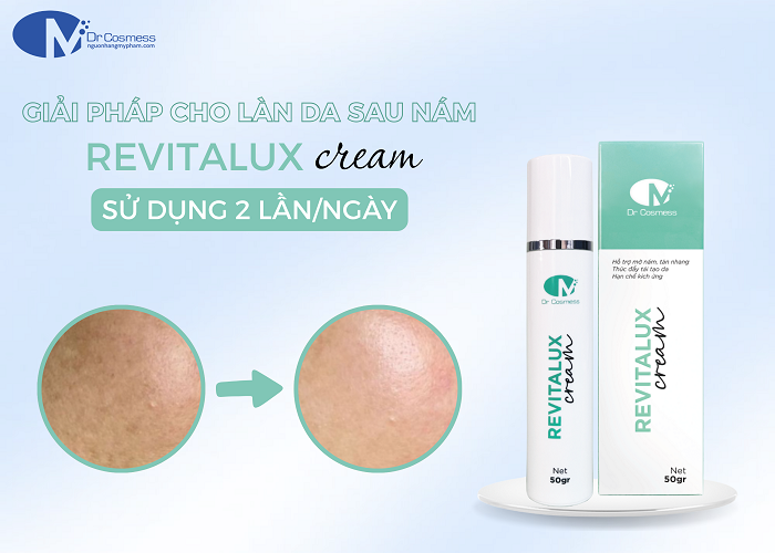 Sản phẩm kem phục hồi và dưỡng da nám Revitalux Cream 